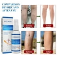 CENGZISHU Spray Feet Spraying To Leg Fatigue Can Promote Skin