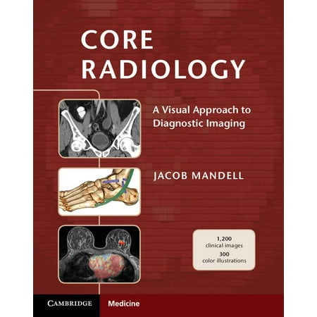 Core Radiology : A Visual Approach to Diagnostic Imaging