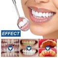 thumbnail image 4 of Eelhoe Bright White Dental Powder Clean Teeth Remove Tartar Teeth Yellow Teeth Stains Oral Whitening Beauty Tooth Powder, 4 of 5