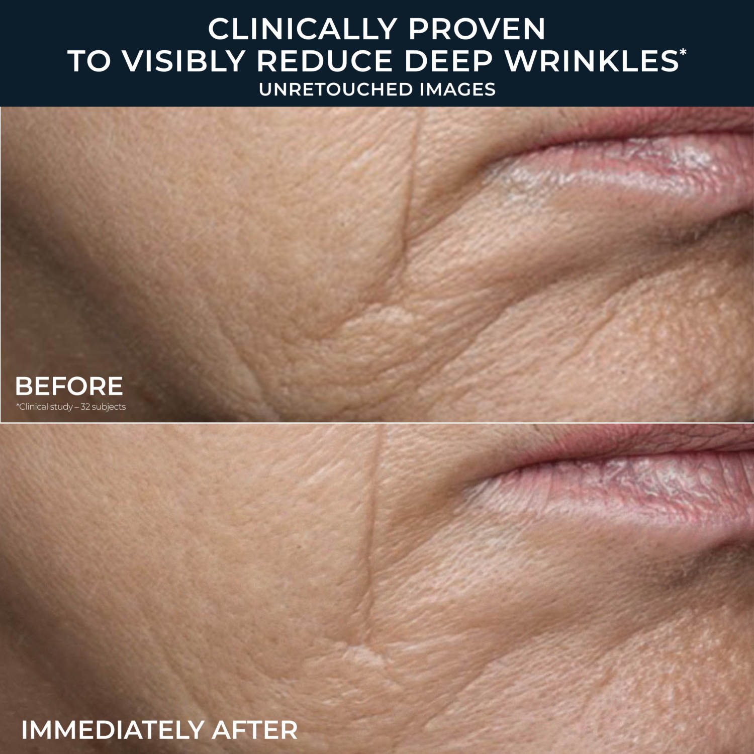 RoC Retinol Correction Deep Wrinkle Rich Cream photo 5