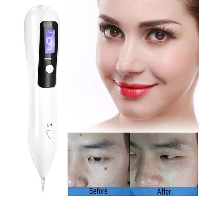 Fugacal Máquina portátil LCD Dot Mole Freckle Spot Tattoo Removal Pen Beauty Skin Machine White Fugacal No se aplica