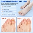 thumbnail image 3 of Fungal Nail Patches, 2025 New Fungal Nail Treatment Patches, Nail Repair Patches,Multi-Purpose Toenail Repair Treatment Pads,Toenail Patches, Antifungal Nail Treatment (2BOX), 3 of 9