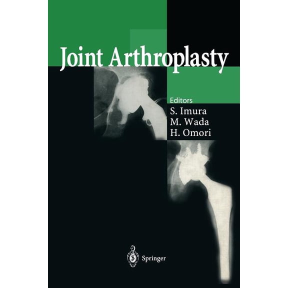 Joint Arthroplasty, (Paperback)