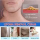 thumbnail image 4 of Crema de eliminación de labios para aliviar el dolor, tratamiento de la hinchazón de la piel, lipólisis, celulitis, manchas de grasa, pomada de eliminación de nódulos, yeso antitumoral, 4 of 5