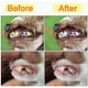 thumbnail image 3 of Cepillos Dentales Walquicks Blanco para Perro y Gato con Eliminación de Placa y Sarro, 3 of 7