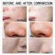 thumbnail image 4 of Mineral-Enriched Peel-Off Mask for Blackhead Removal and Pore Cleansing, Skincare Solution with Magnetic Properties, 4 of 5