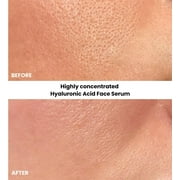 KLEEM ORGANICS Hyaluronic Acid Face Serum for Long Lasting Hydration – 2.5% Hyaluronic Acid Serum for Face with Vitamin C, E & Aloe Vera, 1 fl. oz