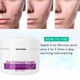 thumbnail image 1 of 50ml Scar Removal Cream Stretch Mark Removal Cream Scar Treatment Cream, 1 of 8