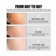 thumbnail image 2 of Facial Brightening Essence with Nicotinic Acid for Hydration and Keratin Removal, 50ml, 2 of 5
