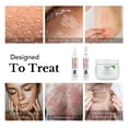 thumbnail image 2 of Theraplex - Anti-Itch Moisturizing Cream (3 oz), Clearlotion Spray (8 oz), and Hydrolotion (8 oz) - Approved by National Eczema Association Seal, your Day and Night Skin Solution, 2 of 9