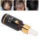 thumbnail image 5 of Suero para el crecimiento del cabello aceite esencial para el cuidado del cabello tratamiento para la caída del cabello aceite esencial nutritivo para el crecimiento del ANGGREK Otros, 5 of 8