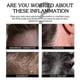 thumbnail image 3 of Cooldown Scalp Eczema Care Roller, 3 of 4