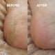 thumbnail image 5 of Lima de vidrio para pies y removedor de callos | Herramienta de pedicura para ducha y eliminación de piel muerta | Exfoliación suave para pies suaves | Diseño portátil para uso doméstico y de viaje, 5 of 9