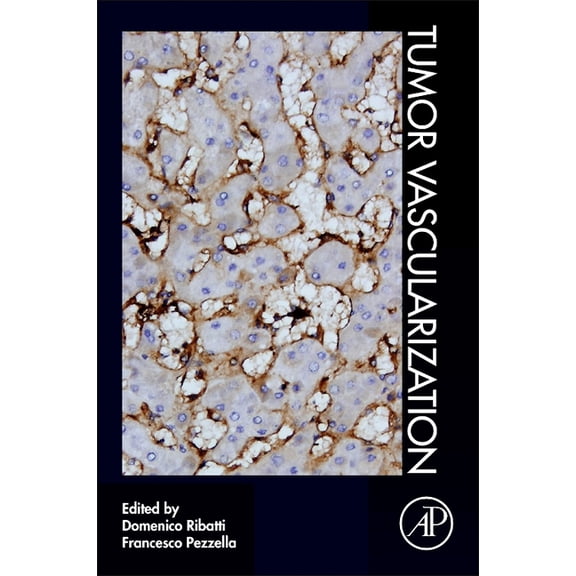 Tumor Vascularization, (Paperback)