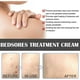 thumbnail image 2 of 2packs Of Rapid Healing Cream Decubitus Repair Cream, 2 of 4