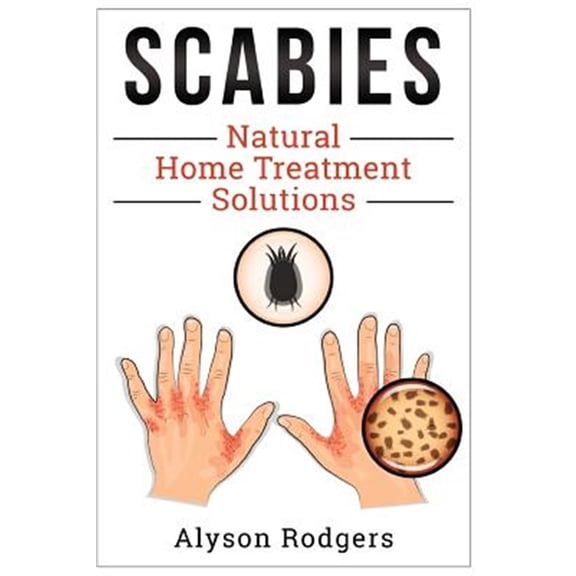 Pre-Owned Scabies Natural Home Treatment Solution