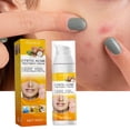 thumbnail image 1 of Pimples Nourishing, Pimples Cream Gently ,Brightens Facial Skin Pimples Treatment,Salicylic Skin Nourishing Removal,Shrink Pores Face Care Pimples Salvador Dali Espinillas Nutritivo, 1 of 5