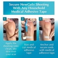 thumbnail image 6 of Advanced Silicone Scar Treatment Sheets for OLD, NEW Scars, Surgery, Keloids, C-Section, Burns, by NewGel Plus by MyNew Gel, 1" x 6" Sheet (2 Count) - CLEAR, 6 of 6