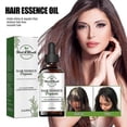 thumbnail image 2 of Aceite Shelure, aceite para el cabello Shelure, aceite para el tratamiento del crecimiento del cabello Shelure, 2 of 5