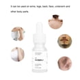 thumbnail image 4 of Sérum inhibidor del crecimiento leve del cabello, 10 ml, unisex, 4 of 9