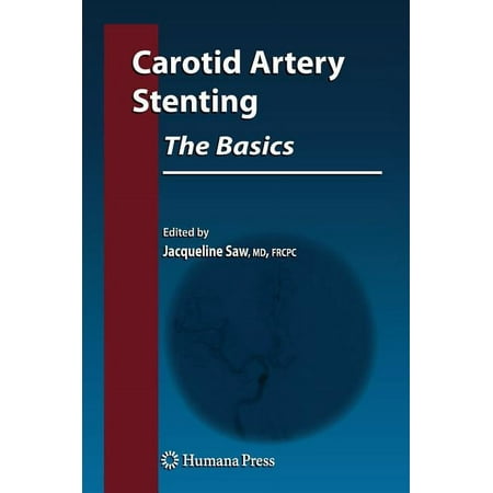UPC: 9781603273138 | Contemporary Cardiology: Carotid Artery Stenting: The Basics (Hardcover)
