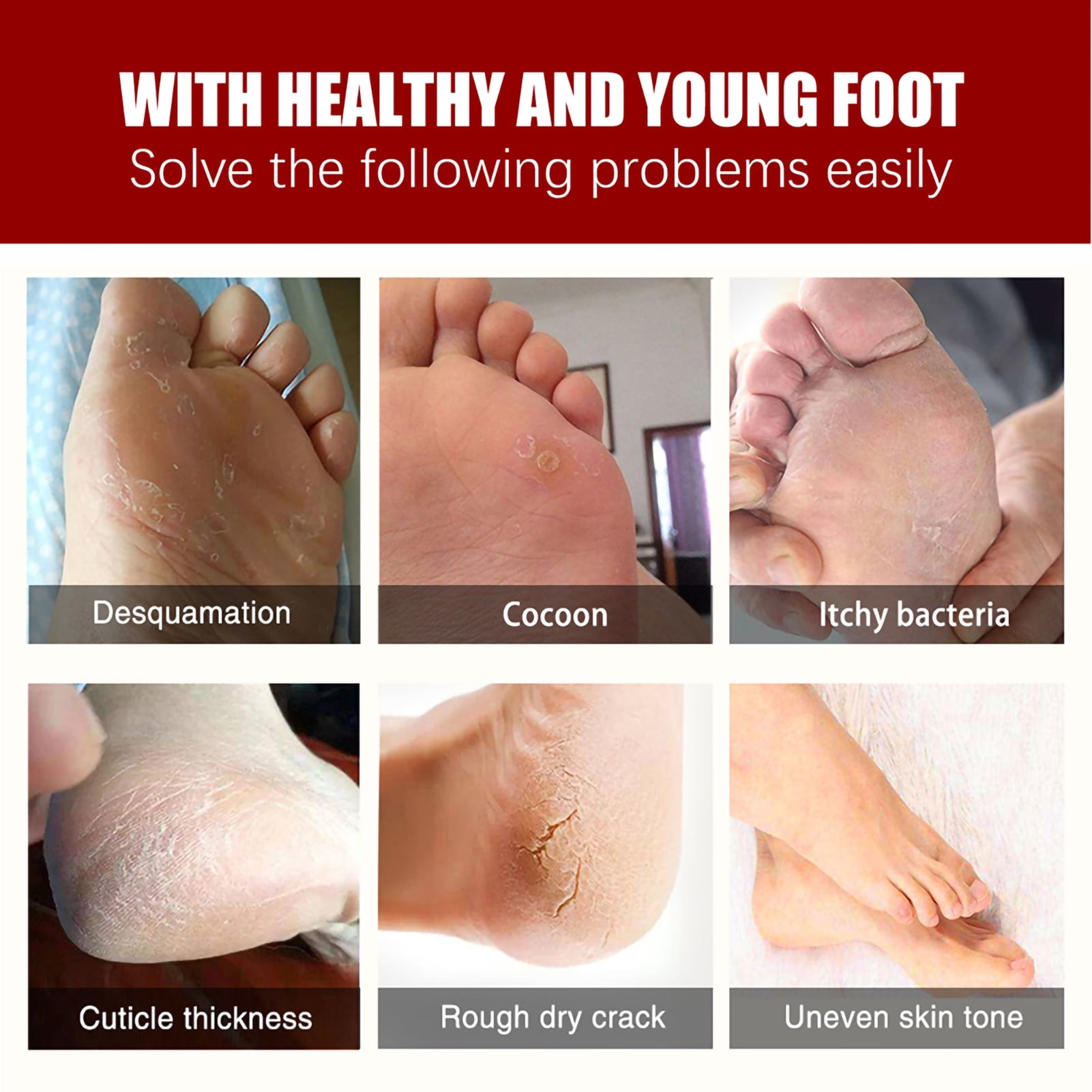 Foot rough skin remover deals