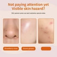 thumbnail image 4 of Fiudx Pala de Acero Inoxidable para Eliminar Puntos Negros, Herramienta para Limpieza Profunda, Ideal para Cuidad Facial, Ideal para Viajes, Apta para Pieles Sensibles., 4 of 7