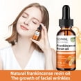 thumbnail image 3 of Aceite de resina de incienso SOPANL reduce las líneas finas, 60 ml, 3 of 6