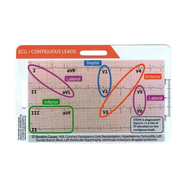 Injueey Tarjeta de bolsillo para ECG, regla automedida, tarjeta de bolsillo compacta y Mini Ecg, tarjeta Uk Ecg de doble cara Kits de experimentos de química B