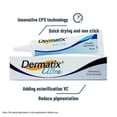 thumbnail image 2 of Dermatix Scar Cream Deep Keloid Scar Removal Stretch Mark Treatment Surgical Burn Wound Skin Regeneration Face Care Ointment, 2 of 5