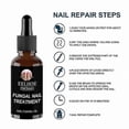 thumbnail image 3 of Anti-Fungal Nail Treatment Serum for Toes & Feet Care Essentials Repair Herb Solution Against Onychomycosis Paronychia Infections, 3 of 5