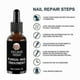 thumbnail image 3 of Anti-Fungal Nail Treatment Serum for Toes & Feet Care Essentials Repair Herb Solution Against Onychomycosis Paronychia Infections, 3 of 5