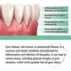 thumbnail image 2 of 1-3x Gum Regrowth Drops, Natural Gum Restore Liquid Mouthwash, Gum Therapy Gel Receding Gum Repair Treatment, 2 of 5