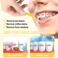 thumbnail image 4 of LELE LIFE 60pcs Interdental Brushes Braces Flossers, Reusable Dental Brushes between Teeth, Braces Brush Floss for Braces Toothbrush, Proxy Brushes Dental Picks, 0.7mm, 4 of 7