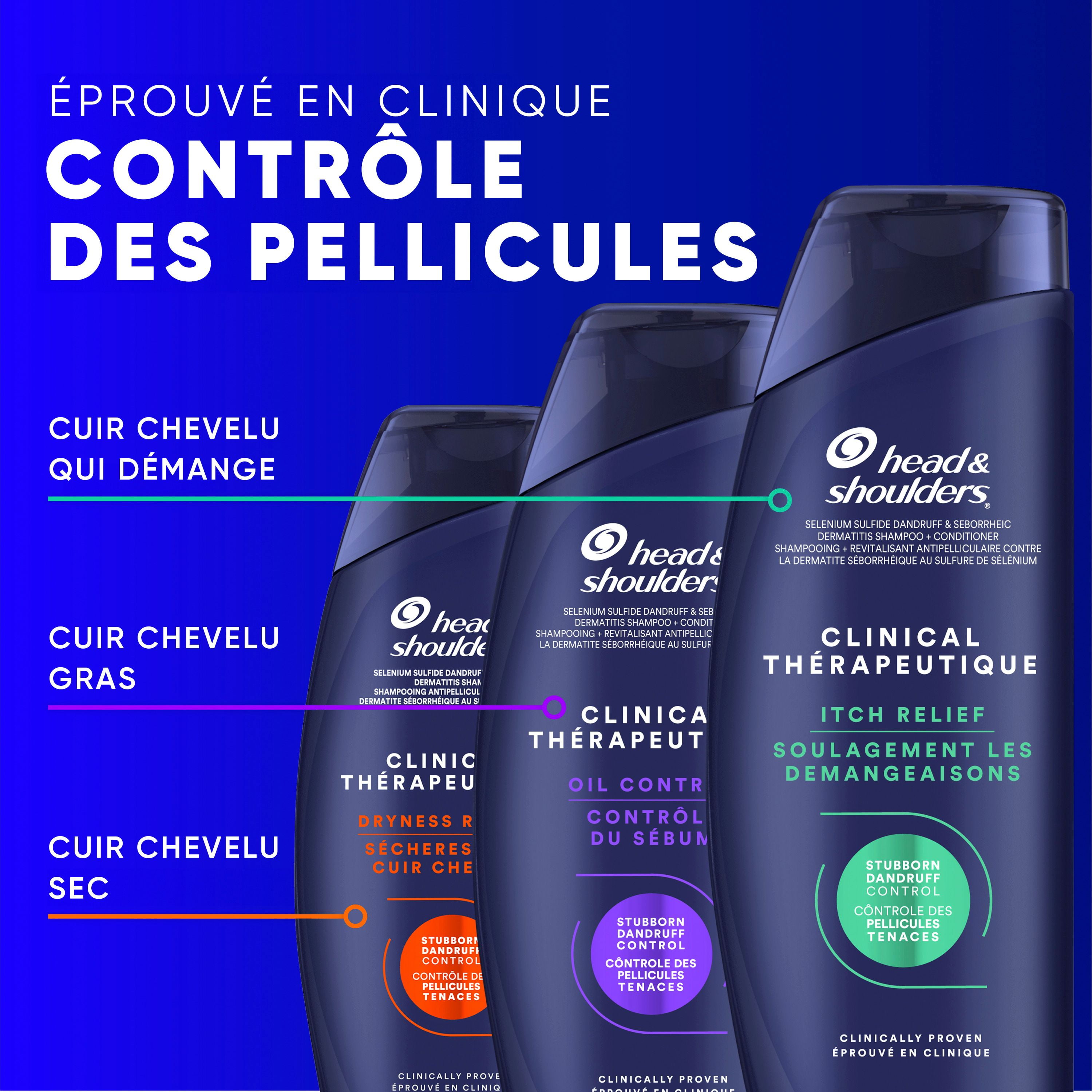 Head & Shoulders Défense Clinique contre les Pellicules + Shampooing Avancé de Contrôle du Sébum 400 ml