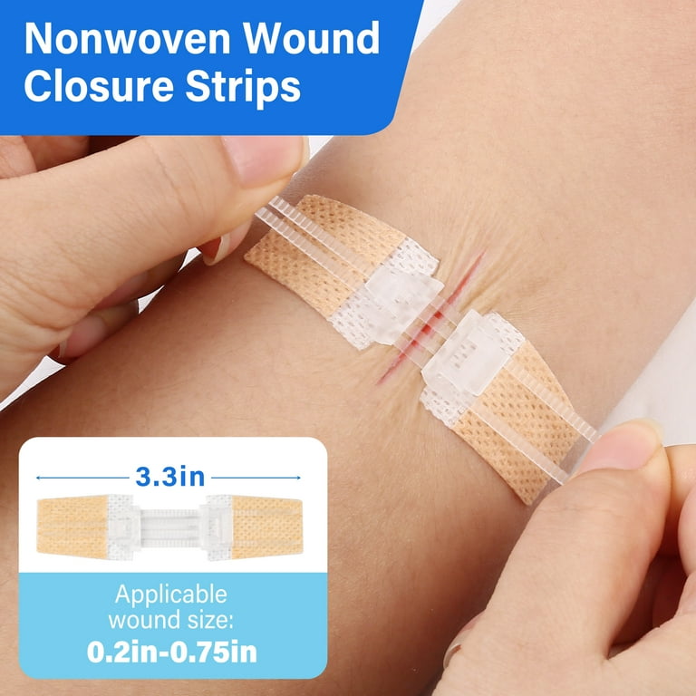 Lotfancy 4 Pack Zip Stitch Sutures, Emergency Surgical Wound Closure Strips, Butterfly Bandages, Size: 4Pcs, White Lotfancy 4 Pack Zip Stitch Sutures, Emergency Surgical Wound Closure Strips, Butterfly Bandages, Size: 4Pcs, White