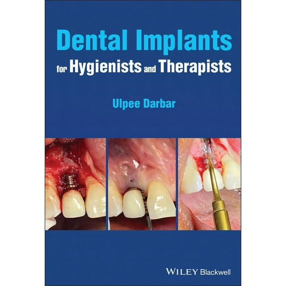 Dental Implants for Hygienists and Therapists, (Paperback)