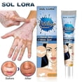 thumbnail image 1 of Vitiligo Skin Repair Cream,Vitiligo Treatment Cream, Dispose of White Spots on Skin and Improve Skin Pigmentation_c*, 1 of 4