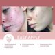 thumbnail image 5 of Mascarilla facial de arcilla y barro rosa para eliminar el acné y los puntos negros, refinar los poros, mascarilla facial de arcilla de limpieza profunda, 5 of 6