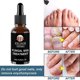thumbnail image 4 of 30ml/50ml Powerful Nails Care Repair Nail Anti-Fungus Onychomycosis Removal, 4 of 4