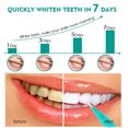 thumbnail image 2 of Mint Teeth Pen Rotating Yellow Stain Removal Teeth Cleaning Pen Allowing You To Maintain Your Teeth Routine No Matter Where You Are 3ml, 2 of 8