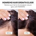 thumbnail image 2 of Sérum para el crecimiento del cabello MONREMO con cúrcuma, cafeína y biotina, 2 of 5