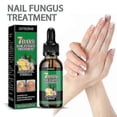 thumbnail image 4 of Jaysuing Ginger Nail Care Solution 30ml Nail Fungus Repair Hand, Foot Nail Care Soft Nail Bright -, 4 of 4