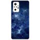 thumbnail image 3 of Funda para Xiaomi Redmi Note 10 Funda Note 10S Silicona Suave TPU Fundas Cover para Redmi Note 10 Pro Versión Global Teléfono Bumper, 3 of 5