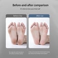 thumbnail image 4 of relayinert Water Washed Foot Gentle Skin Care For Healthy Feet Small And Portable Electric Foot Trimmer green, 4 of 6