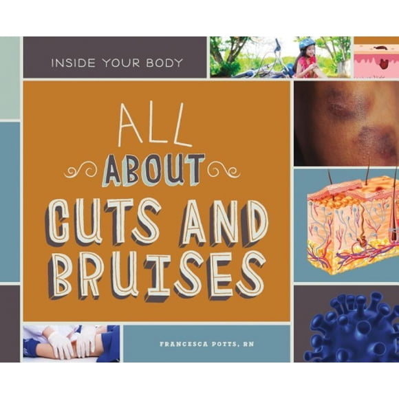 All about Cuts and Bruises (Inside Your Body)
