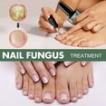 thumbnail image 2 of Líquido Para Hongos En Las Uñas Líquido para el cuidado de hongos en las uñas, 15ml, reparación de esencia de uñas, reparación de cutículas de uñas de los pies dañadas Ndcxsfigh Cuidado Belleza, 2 of 3