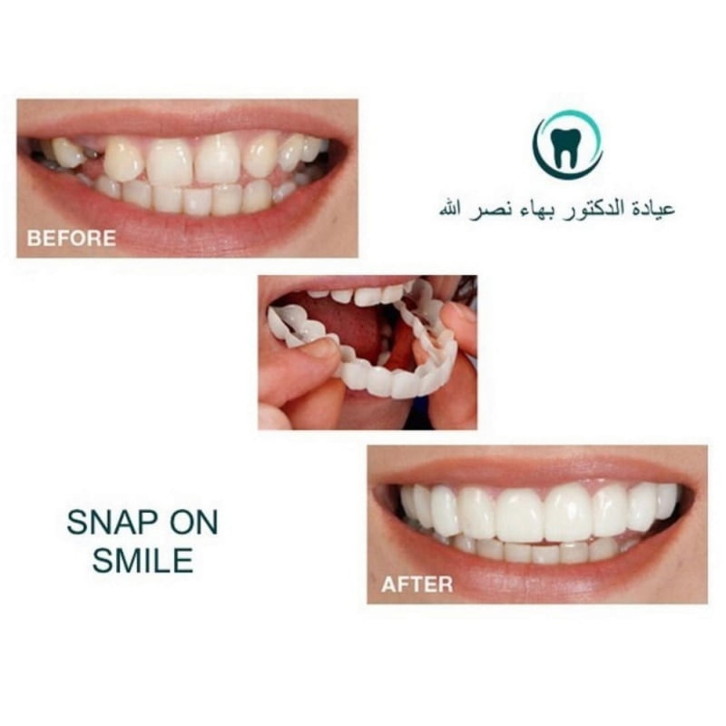 Braces Cosmetic Snap On Instant Perfect Smile Comfort Fit Flex Teeth Veneers Denture For Top Teeth To Make White Tooth Beautiful Neat Walmart Com Braces Cosmetic Snap On Instant Perfect Smile Comfort Fit Flex Teeth Veneers Denture For Top Teeth To Make White Tooth Beautiful Neat Walmart Com