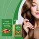 thumbnail image 3 of El champú Hoegoa Batana para el cuidado del cabello utiliza ingredientes suaves para limpiar el cabello, hacerlo ligero y suave e hidratarlo.,1 piezas, 3 of 12