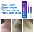 thumbnail image 2 of 2 uds removedor de verrugas pluma para etiquetas de piel papilomas eliminación de lunares herramientas de punto indoloras Sywqhk Cuidado Belleza, 2 of 7